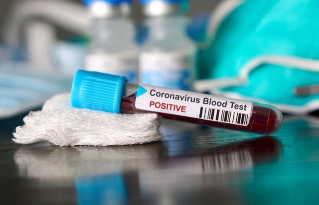 В Закарпатье 27 человек умерло от коронавируса
