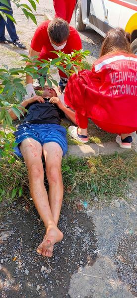 Лицо всё в крови: В Ужгороде охранники избили человека с особой жестокостью 