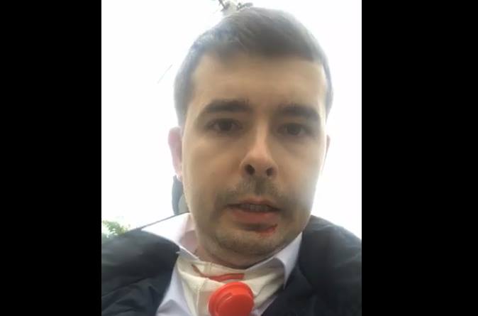 В Ужгороде камеры зафиксировали момент жестокого избиения кандидата в депутаты