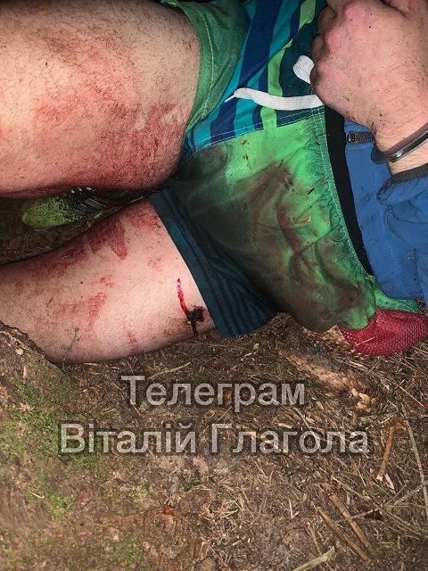 В Черновицкой области на границе застрелили уклониста 