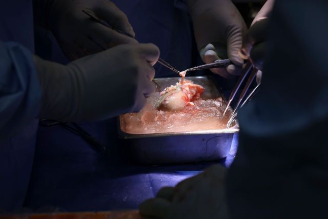 В США провели первую в мире пересадку почки свиньи живому человеку