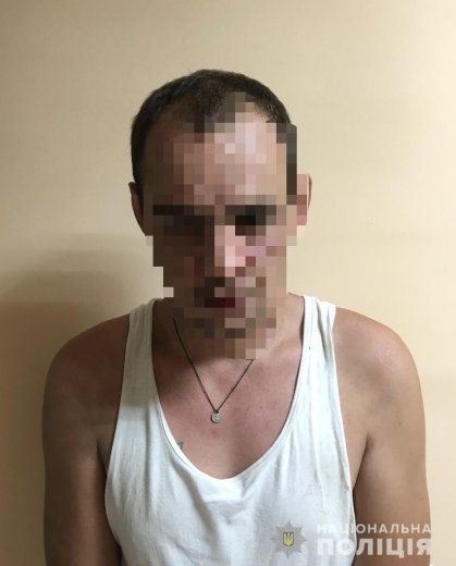 Избил и убежал: В Ужгороде посреди улицы напали на человека 