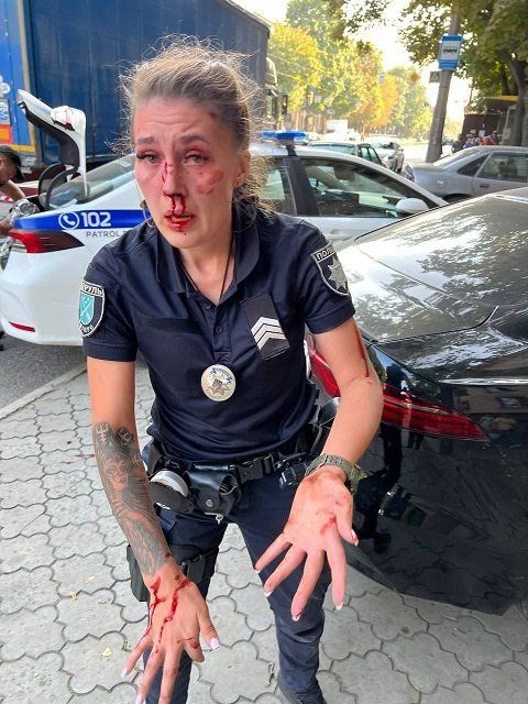 Фото патрульной А. Жилы, на которую напал водитель в Днепре. 
