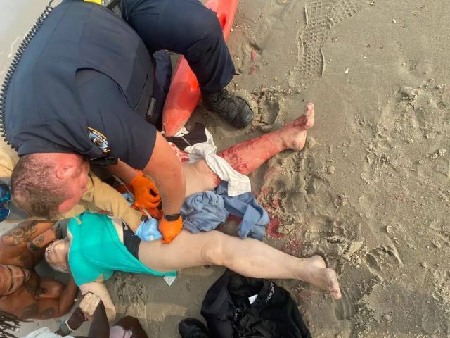 Откусила часть ноги: Акула напала на украинку на пляже Нью-Йорка