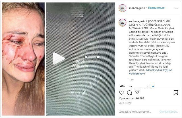 Видео избиения украинской модели Дарьи Кирилюк попало в соцсети: Под подозрением - бойфренд