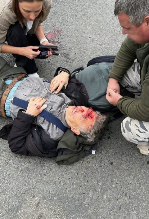 В Ужгороде мужчина попал под колеса авто