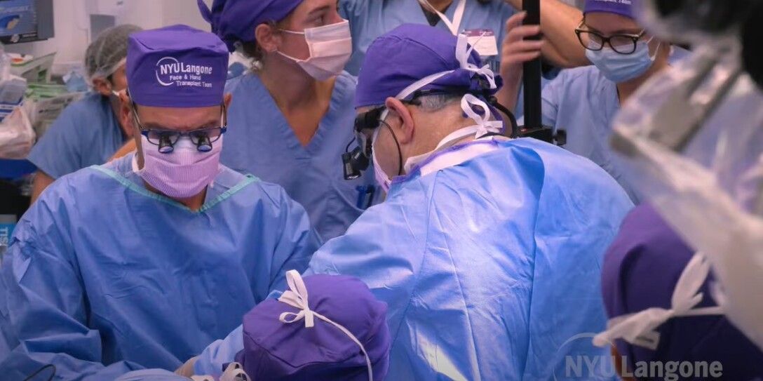 В США врачи впервые в мире сделали успешную пересадку лица и рук пациенту 