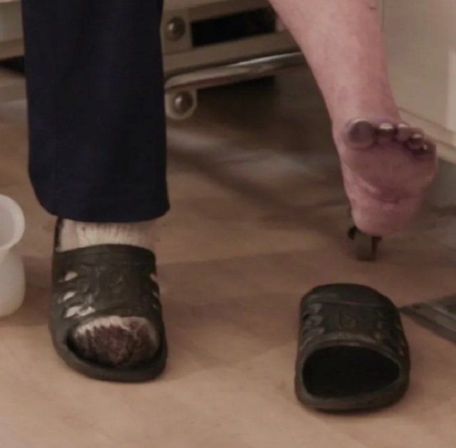 Во львовской больнице пациенты лишились ног из-за коронавируса