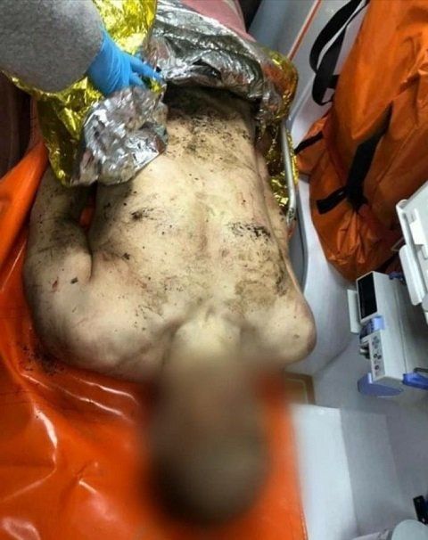 Труп без одежды: В Закарпатье обнаружили мертвого мужчину