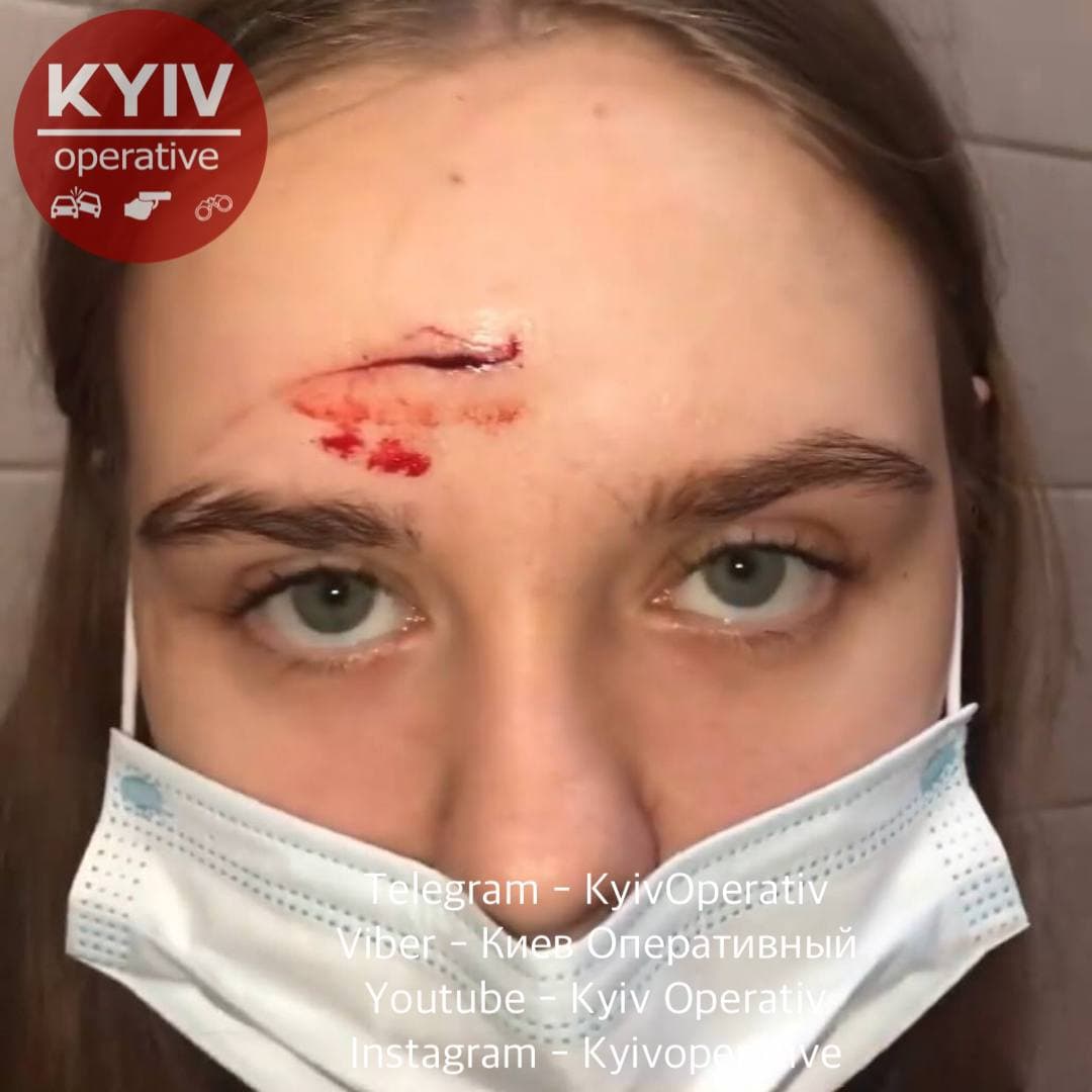 "Ты не знаешь, с кем взялась": В Киеве посетительницу Осеаn Plaza жестоко избили