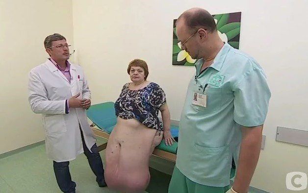 Хирурги со стажем были в шоке от увиденного на программе "Я соромлюсь свого тіла"