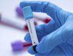 Девять десятков жителей Закарпатья заболели коронавирусом за последние сутки
