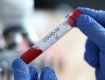 За добу в Ужгороді підверджено 22 нові випадки захворювання на коронавірус