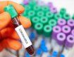 Жорсткими методами локалізують осередок захворюваності на коронавірус серед медиків у Мукачево