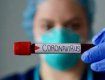 Кількість інфікованих коронавірусом мешканців Закарпаття зросла до 387 осіб