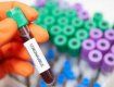 У Мукачеві — 9 підтверджених випадків захворювання на коронавірус за добу