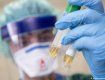 Антирекорд: В Закарпатье за последние сутки найдено 34 новых случая коронавируса 