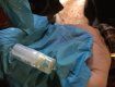 Сільського стоматолога затримали при збуті наркоречовини на Закарпатті