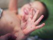 В Одесской области от кори умер 5-месячный ребенок