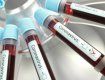 375 инфицированных: В Закарпатье количество зараженных коронавирусом растёт как на дрожжах 
