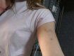 Синяки на шее, пояснице и на руках: В Закарпатье полицейский избил девушку 