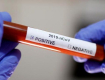 Внезапно: В Закарпатье за сутки 94 человека выздоровели от коронавируса 