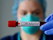 В Закарпатье за сутки 81 человек заразился COVID-19, а один скончался 