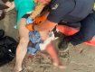 Откусила часть ноги: Акула напала на украинку на пляже Нью-Йорка