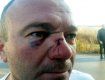 В результате мордобоя на украинско-румынской границе в Закарпатье пострадали дальнобойщики из Сербии
