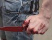 В Закарпатье только ножевое ранение остановило семейную ссору