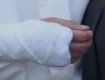 За съемку ДТП журналисту сломали руку