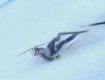 Лыжница из Закарпатья умерла в реанимации после несчастного случая на "Буковеле"