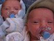 В Великобритании родились редкие близняшки