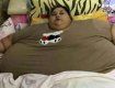 Египтянка весом в полтонны покинула дом первый раз за 25 лет