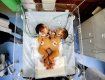 В Словакии сиамские близнецы умерли после операции