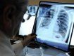 В Ужгороде растет количество больных с открытой формой туберкулеза