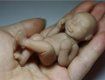 В Закарпатье устанавливают причины смерти 1-месячного малыша