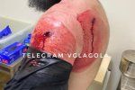 Простреленное плечо, пуля прошла на вылет: Эксклюзивные фото с места резонансной перестрелки в Мукачево