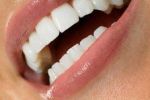 Закарпатье станет центром стоматологического туризма