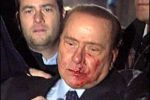 Избиение Сильвио Берлускони инсценировано?