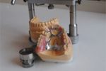На Закарпатье впервые пройдет Чемпионат зубных техников