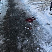Мукачівець серйозно травмувався через нерозчищені тротуари