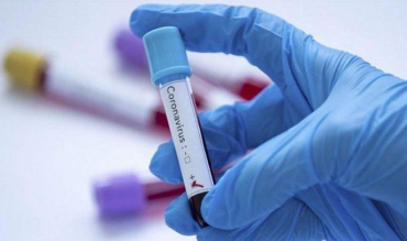 Офіційно. В Україні — 3 627 нових хворих на коронавірус