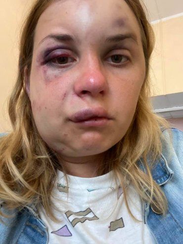 История, шокировавшая соцсети: В поезде "Мариуполь-Киев" жестоко избили и пытались изнасиловать пассажирку с сыном 