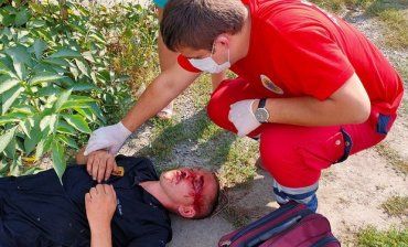 Лицо всё в крови: В Ужгороде охранники избили человека с особой жестокостью 