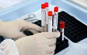 За останню добу в Ужгороді виявлено 63 нових хворих на коронавірус