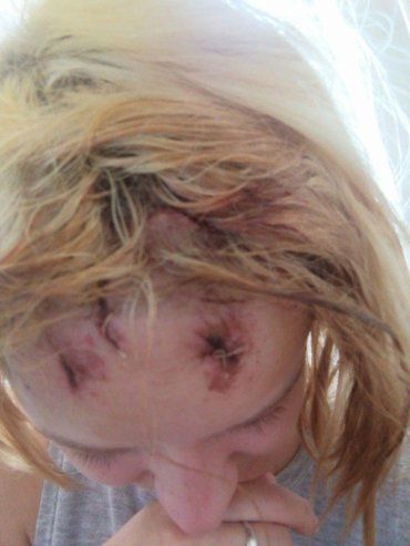 У столиці Закарпаття посеред білого дня напали на дівчину, пограбували й надавали їй по голові