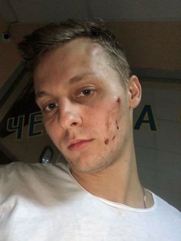У ресторані в Києві побили Олександра Шуфрича