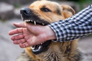 За неповні три тижні січня з приводу укусів собак до лікарів звернулися 5 мешканців міста Ужгород