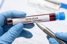 Коронавірус наступає. В Україні підтверджено 40 випадків COVID-19